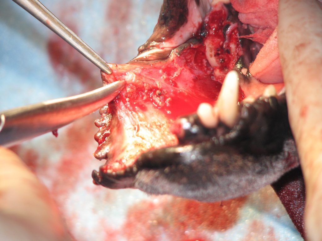 口腔内腫瘍